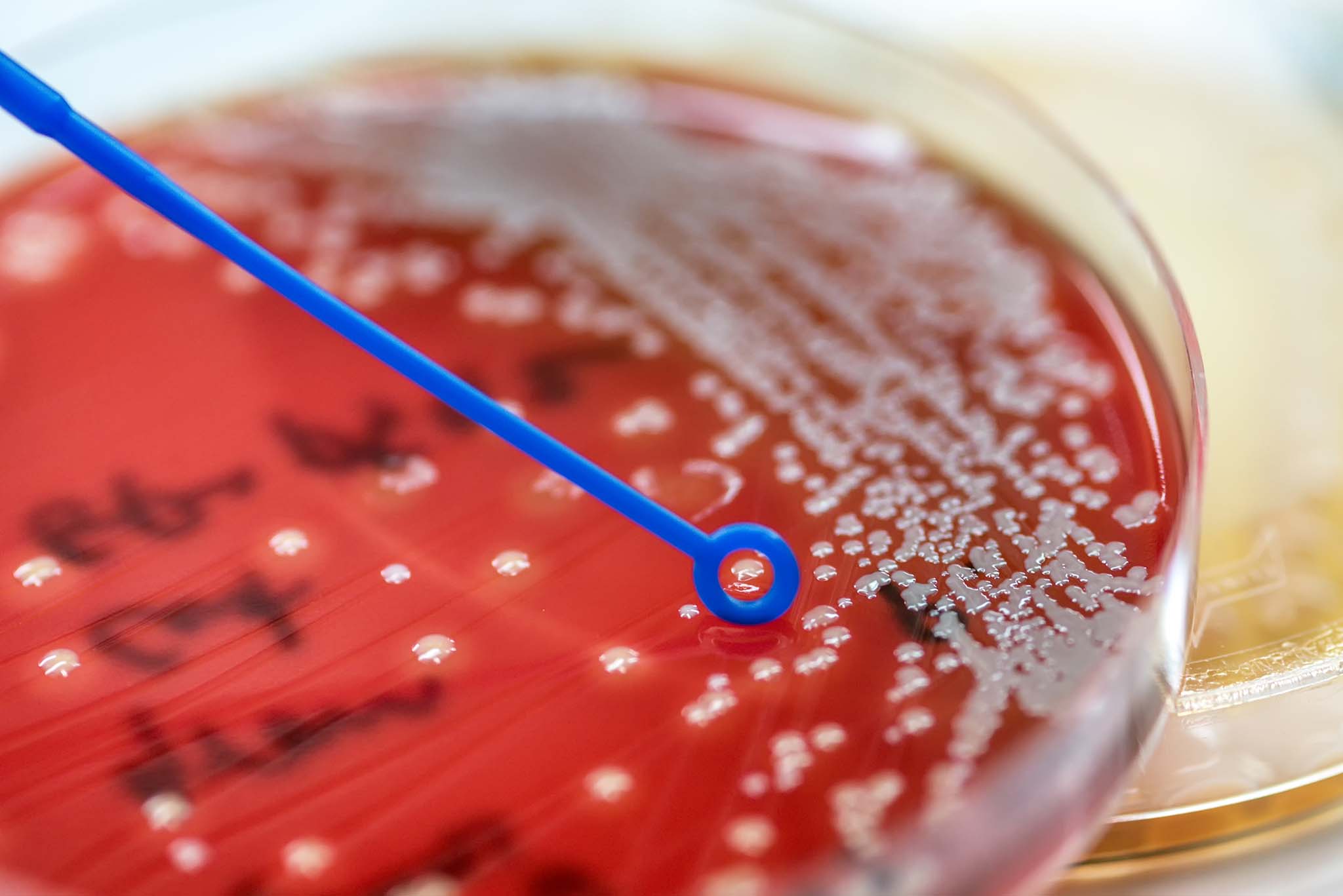 Keimzahlbestimmung Kosmetik Bakterien Labor für Mikrobiologie